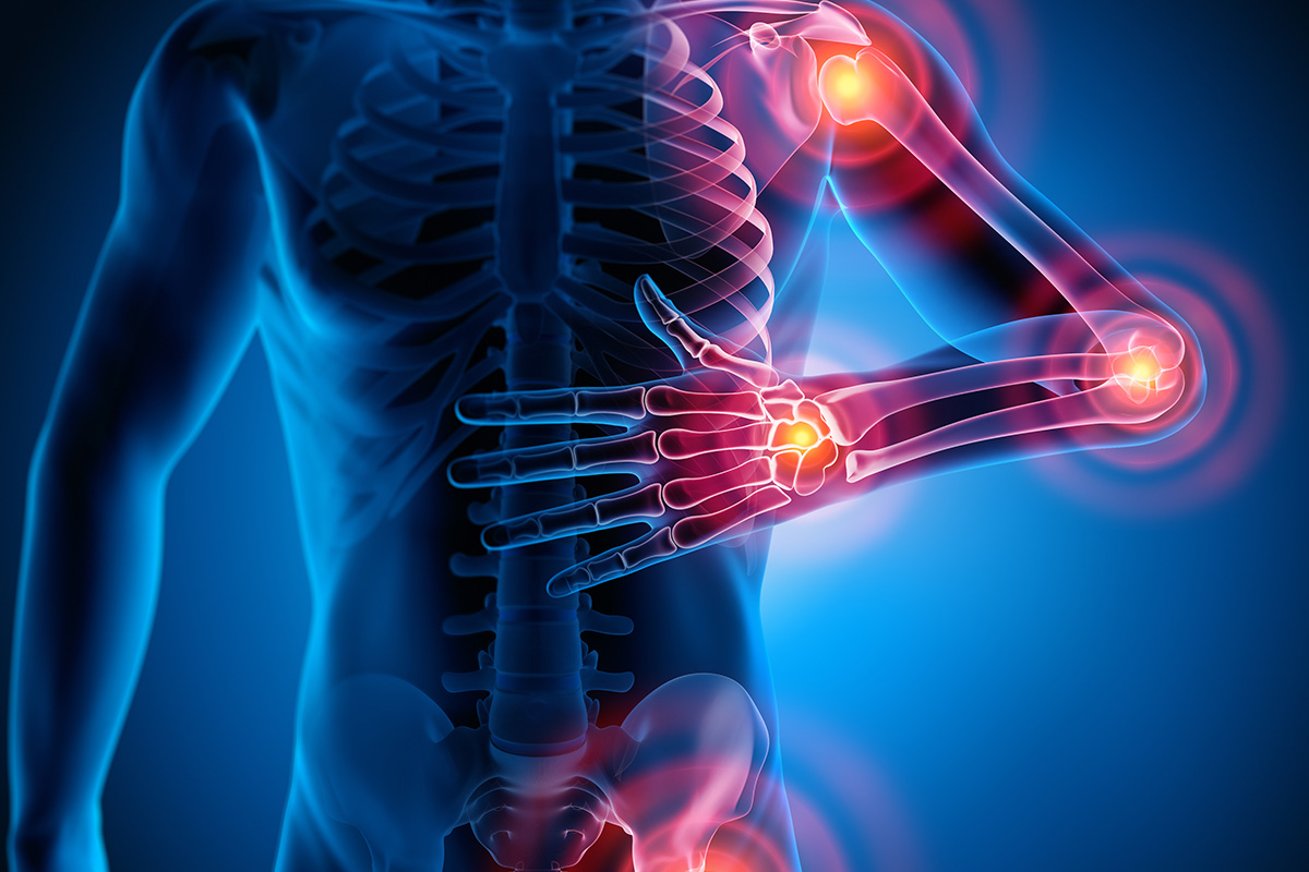 Informa IMSS Veracruz Norte sobre fibromialgia, enfermedad crónica e invalidante