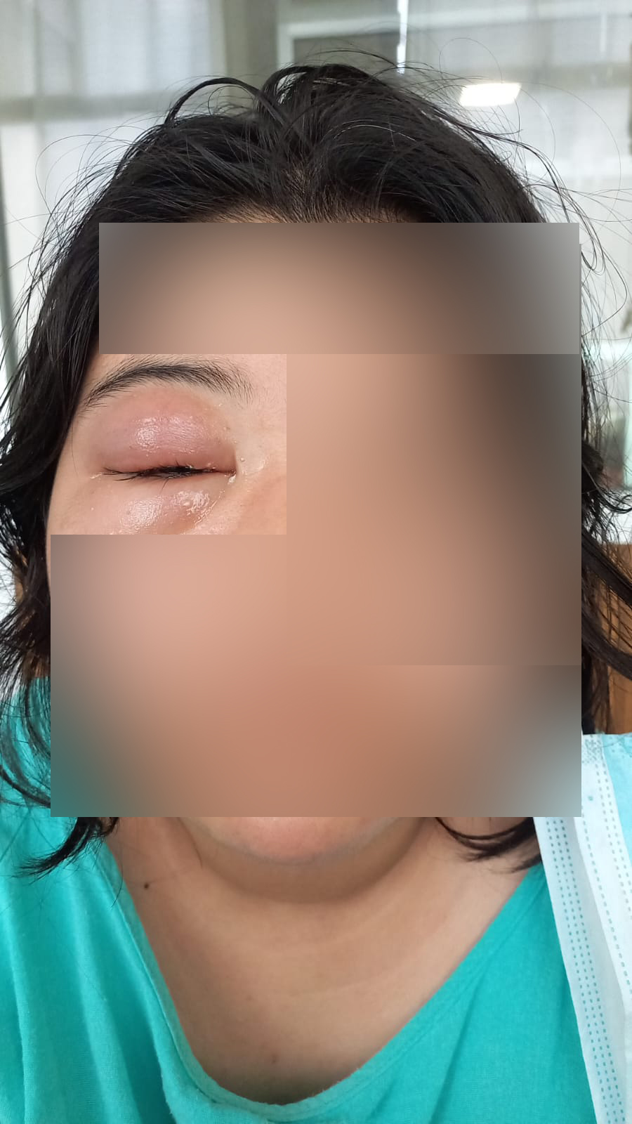 Reconoce IMSS Veracruz Norte importancia de la fotografía es un recurso al servicio de la salud