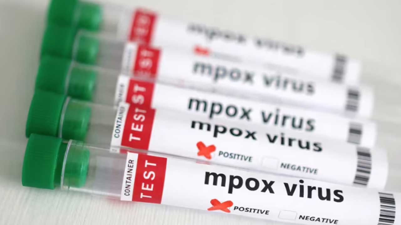 La CDMX con el mayor número de casos de la viruela del mono; el país suma 23 casos