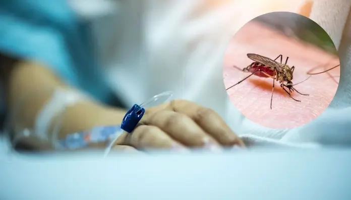 Alerta por brote del virus mortal Chandipura; estos son los síntomas y así se contagia