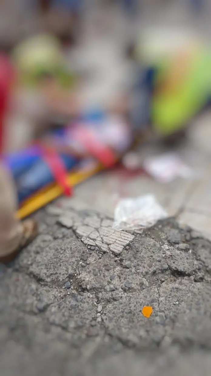 Motociclista lesionado tras choque con camioneta en Catemaco