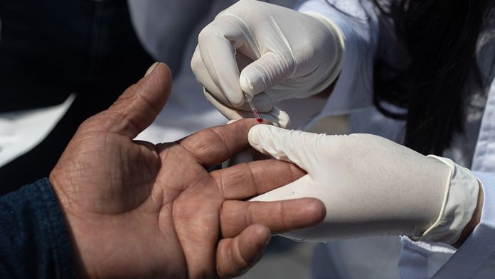 El estado de Veracruz se ubicó en el segundo lugar de casos de VIH/Sida del país