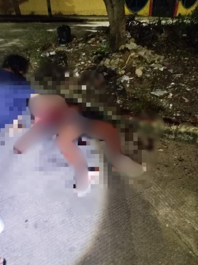 Un muertø y un her1do tras riña