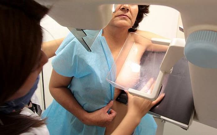 Refrenda IMSS Veracruz Norte invitación a mujeres de 40 a 69 años a realizarse la mastografía