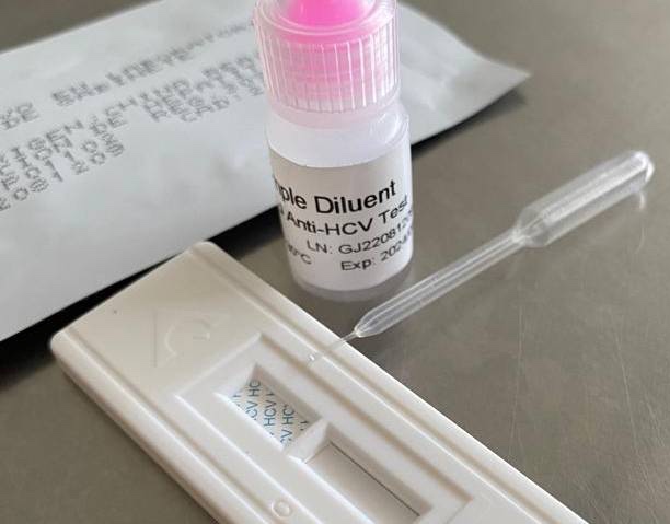 Recomienda IMSS Veracruz Norte a población derechohabientes a realizarse prueba rápida de detección de hepatitis C