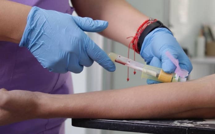 Aumentan casos de sífilis en el puerto de Veracruz