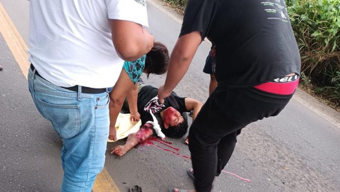 Accidente deja motociclista herido de gravedad en San Andrés Tuxtla