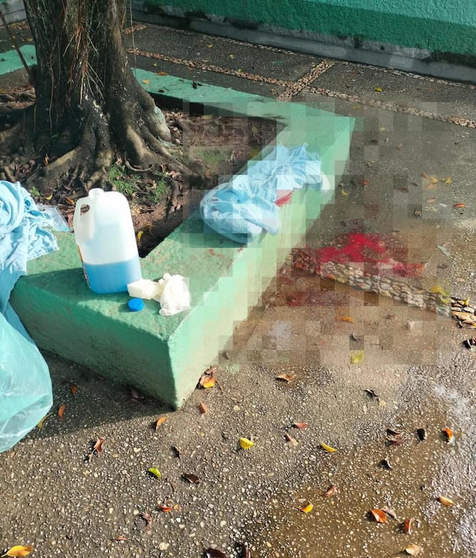 Mujer da a luz en el patio del IMSS Coplamar en Jáltipan