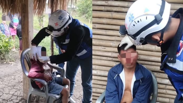 Padre e hijo heridos al derrapar en motocicleta