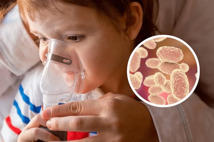 Emiten aviso epidemiológico por aumento de tos ferina en México