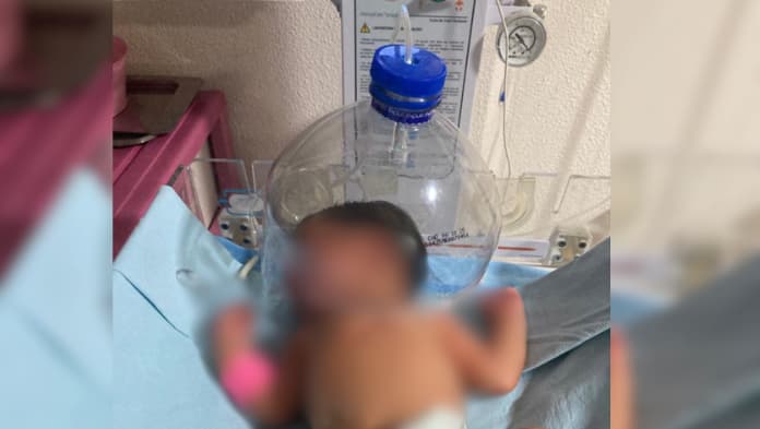 Suspenden a director y administrador de hospital de Macuspana por utilizar botella de plástico como casco para recién nacido
