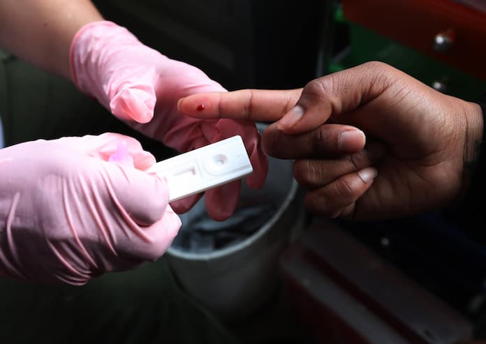 Aumentan los casos de VIH en Yucatán