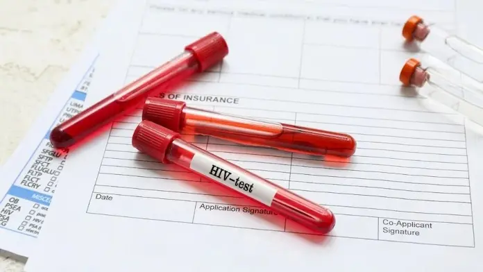 FDA aprueba en Estados Unidos nuevo tratamiento inyectable para prevenir el VIH