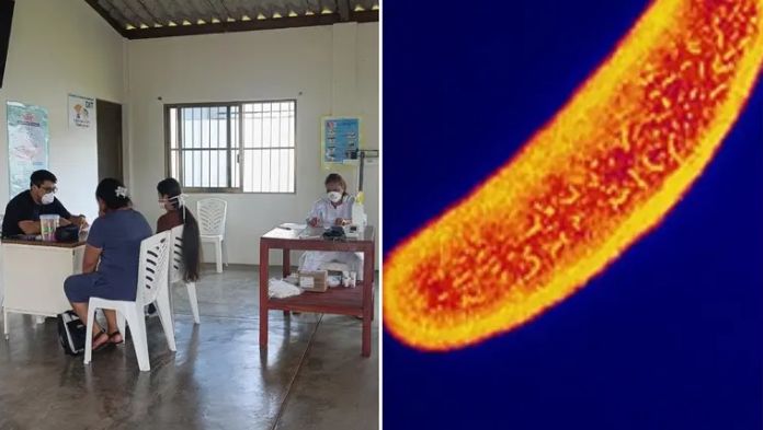 Confirman 245 casos de infecciones diarreicas en Tatahuicapan; descartan cólera en Veracruz