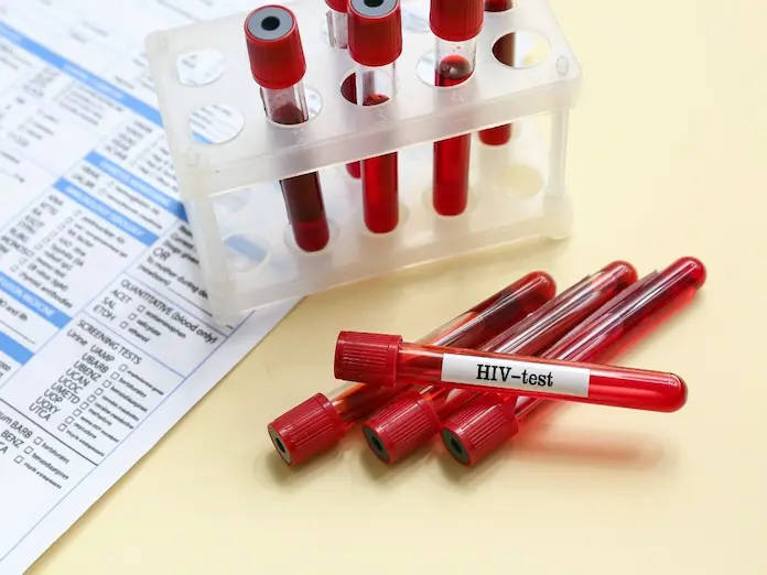 Día Nacional de la Prueba de Detección del VIH 28 de noviembre 2025