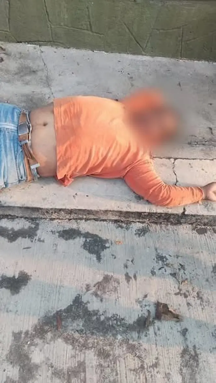 Choque entre moto y camioneta deja un lesionado en Catemaco