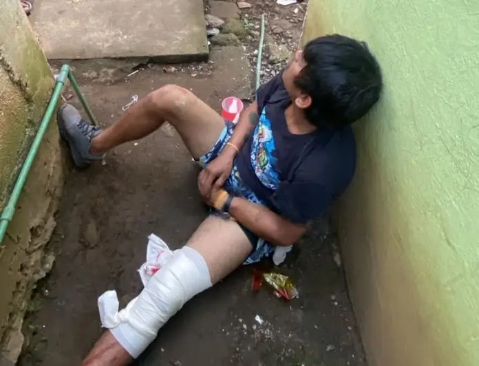 Hombre es herido por arma blanca en San Andrés Tuxtla