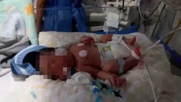 Tos ferina mata a 72 bebés en México; estos son los síntomas de la enfermedad