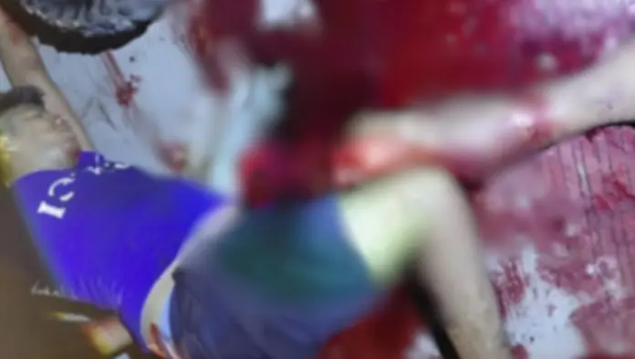 Motociclista sufre aparatoso accidente en la carretera San Andrés–Tilapan