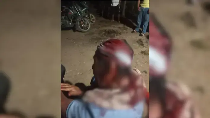 Adulto mayor es herido tras agresión con machete en zona rural de Las Choapas