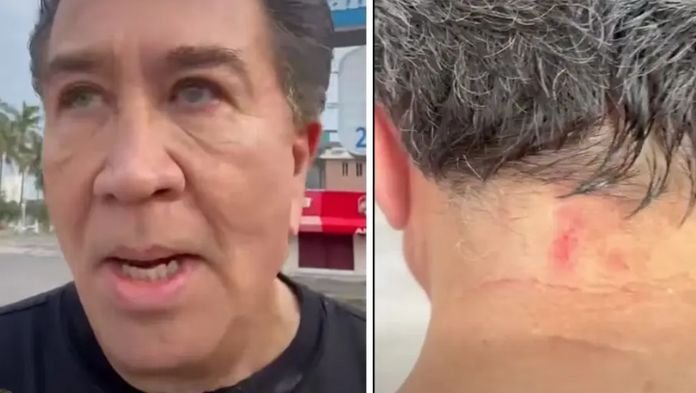 Héctor Yunes denuncia asalto en playa de Boca del Río, Veracruz; le roban cadena